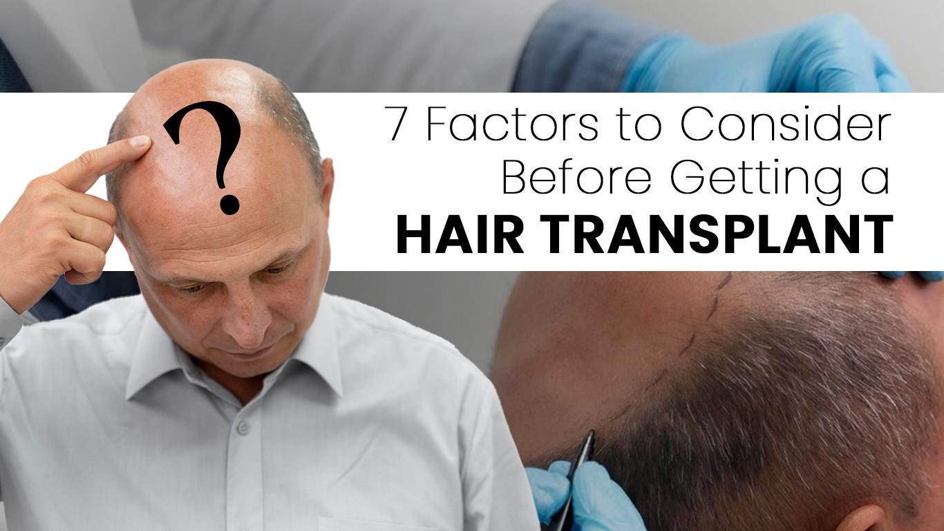 7 Factors to Consider Before Getting a Hair Transplant