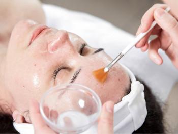 Glycolic Peel