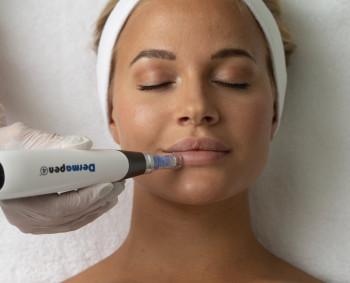How Do Derma Pens Work