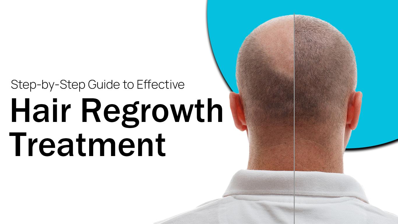 Step-by-Step Guide to Effective Hair Regrowth Treatment