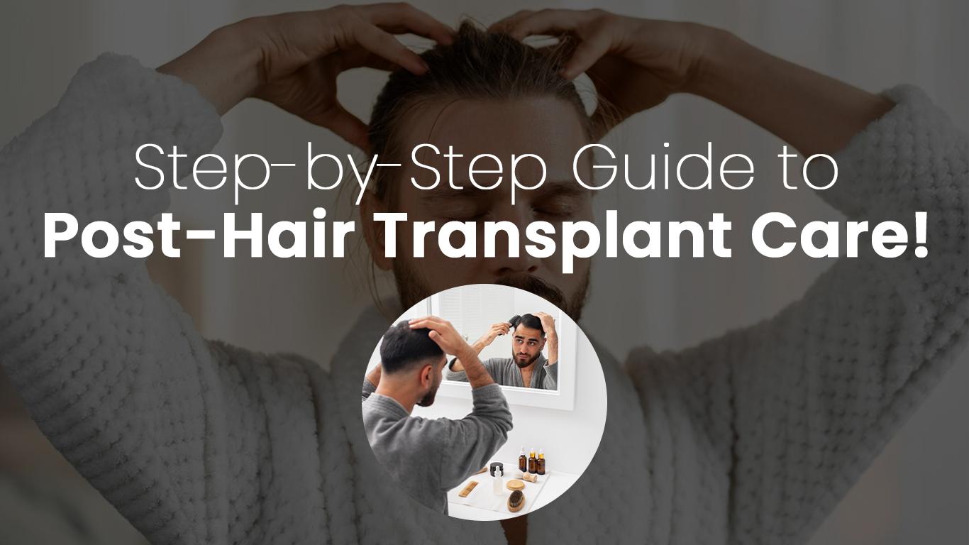 Step-by-Step Guide to Post-Hair Transplant Care